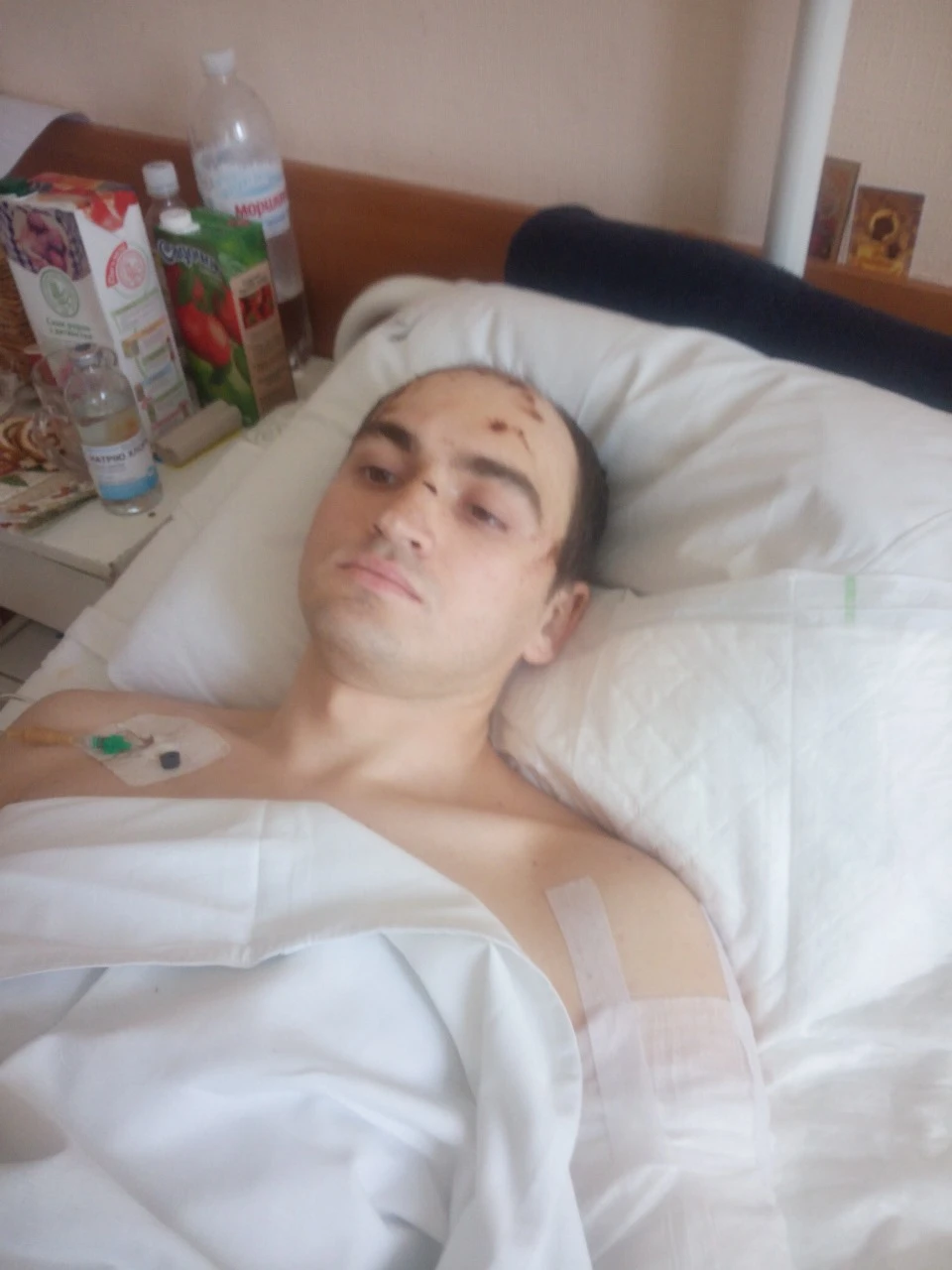 Поранений під Дебальцевим захисник створює кібернетичні протези для ветеранів