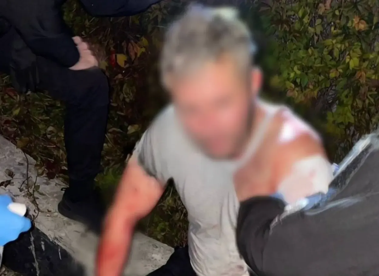 У Києві затримано підозрюваного у вбивстві: тричі вдарив ножем перехожого