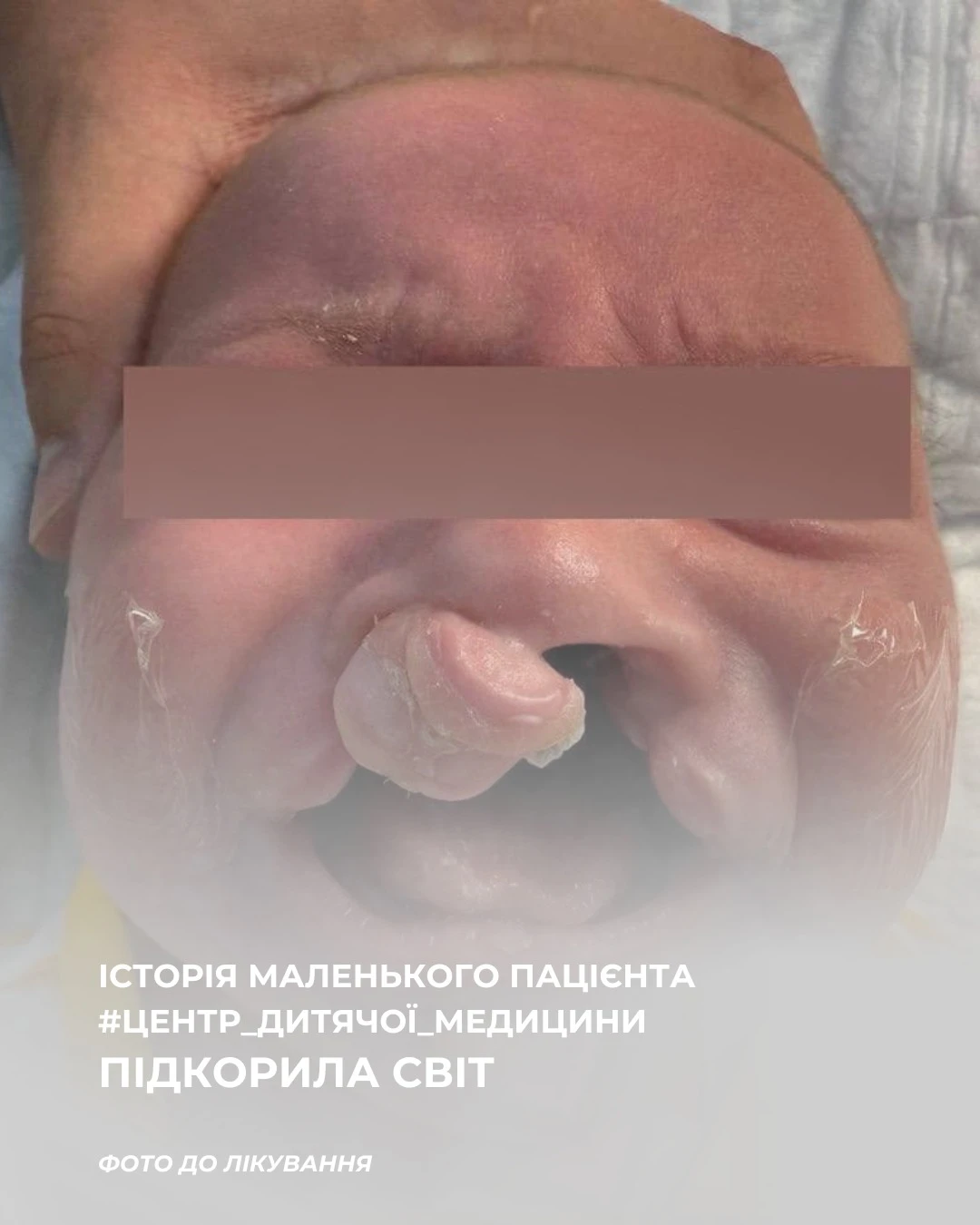 В Івано-Франківську провели унікальну операцію малюку, яка отримала світове визнання