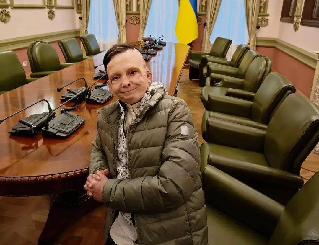 Роман Олексів отримав президентську відзнаку після 35 операцій та двох років реабілітації